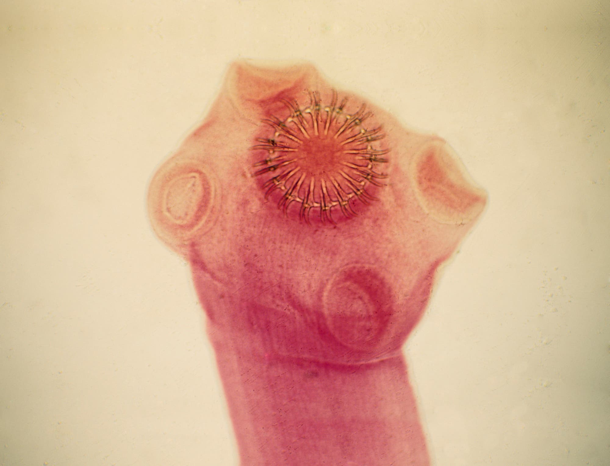 Kopfteil eines Schweinebandwurms mit einem zenralen saugnapfartigen Haken und vier darum angeordnete Beulen
