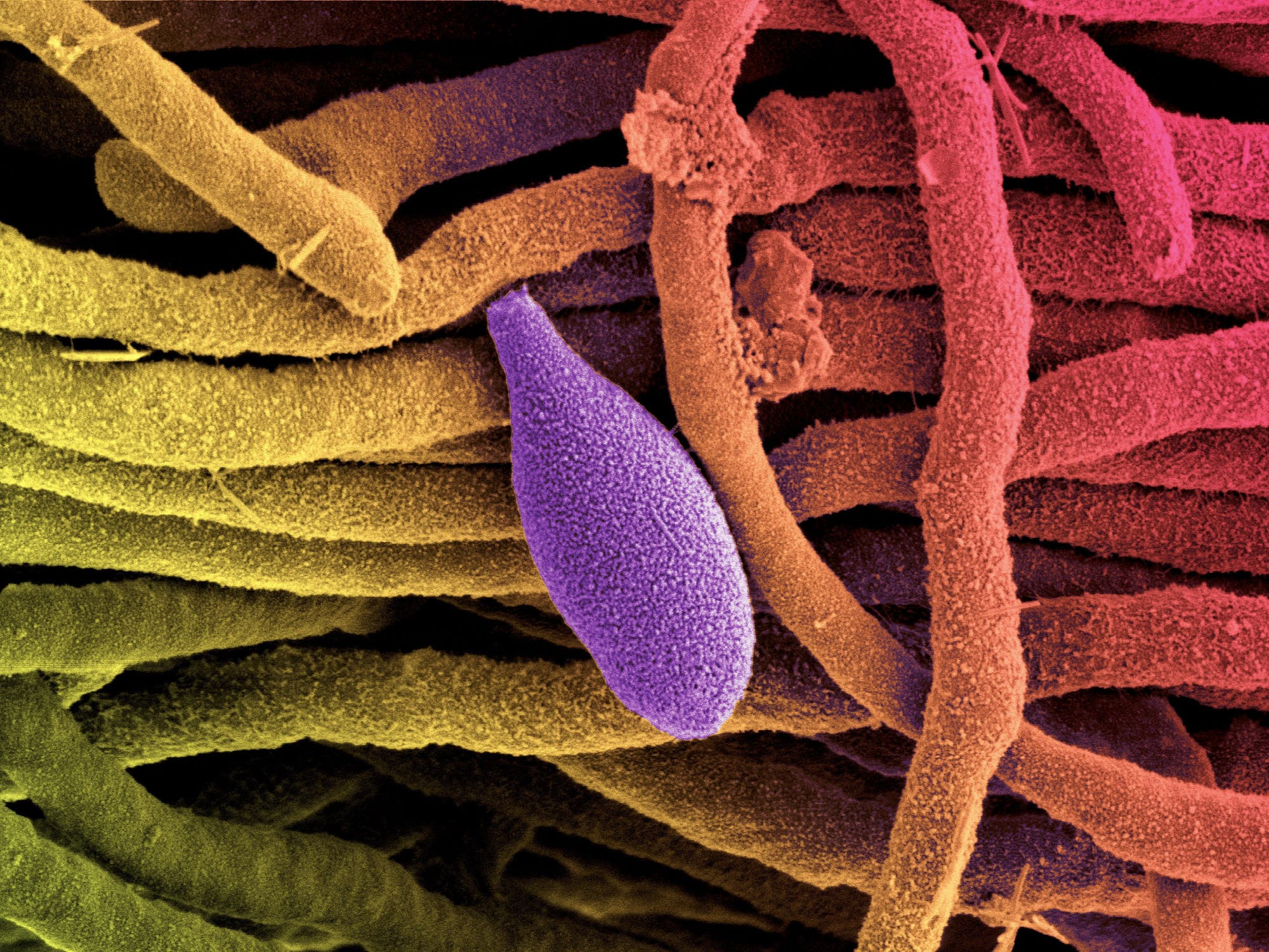 Eine Elektronenmikroskopaufnahme eines länglichen Einzellers (in lila eingefärbt), der zur Gattung Sporothrix gehört