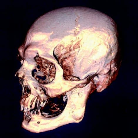 Schädel der ägyptischen Mumie