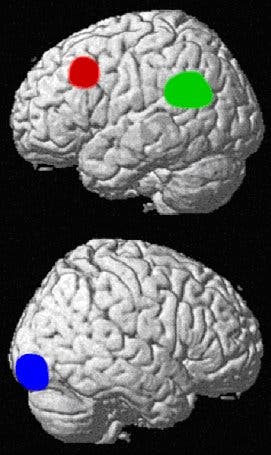 Betroffene Hirnregionen bei Legasthenikern