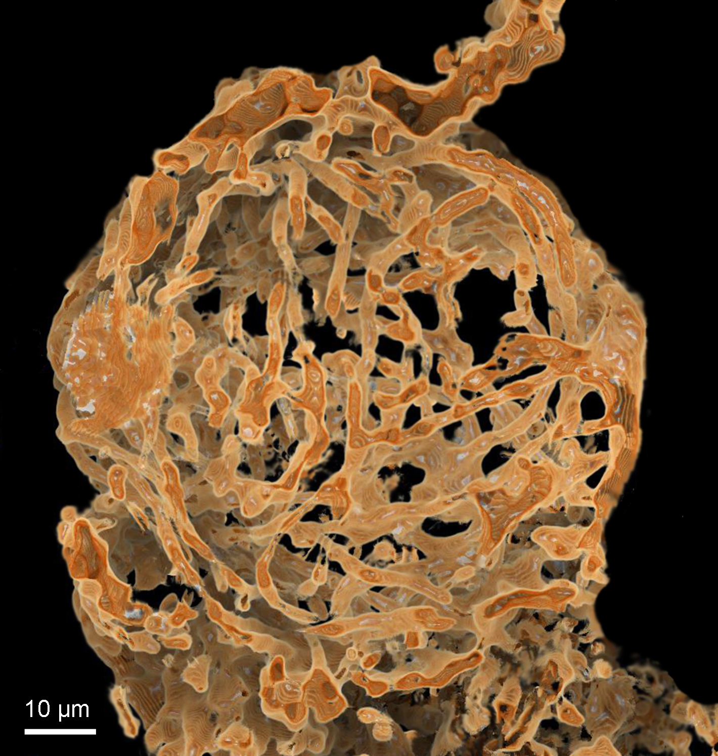 Die Rekonstruktion zeigt eines der beiden Speicherorgane für Spermien aus einem Weibchen der kreidezeitlichen Myanmarcypris hui. 