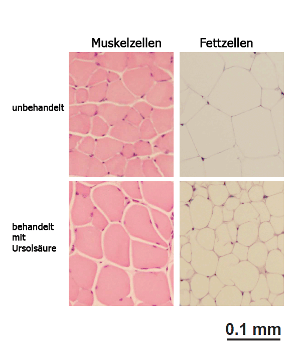 Mikroskopische Ansicht von Muskel- und Fettzellen
