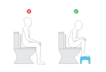 Einfache Grafik mit der Darstellung der falschen Sitzhaltung mit gerade aufgestellten Beinen, und rechts der korrekten Sitzhaltung mit den Beinen aufgestellt auf einem Hocker.