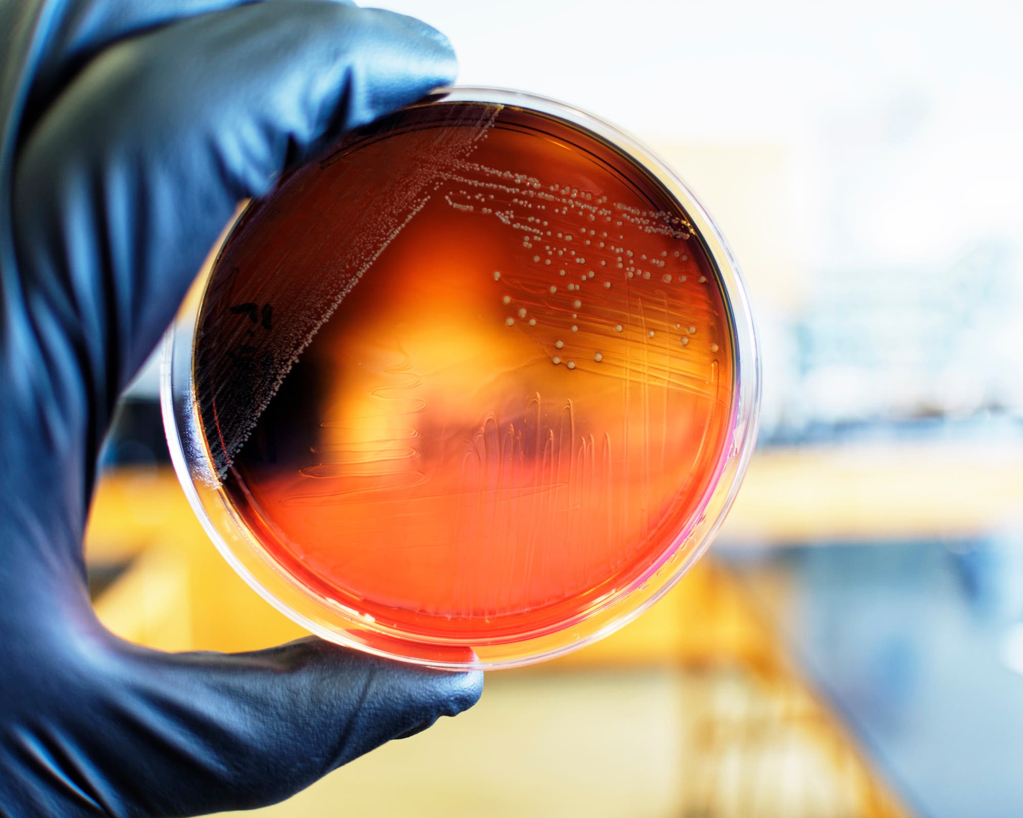 Eine behandschuhte Hand hält eine Petrischale mit rötlichem Nährmedium, auf dem Bakterienkolonien der Art Listeria monocytogenes wachsen.