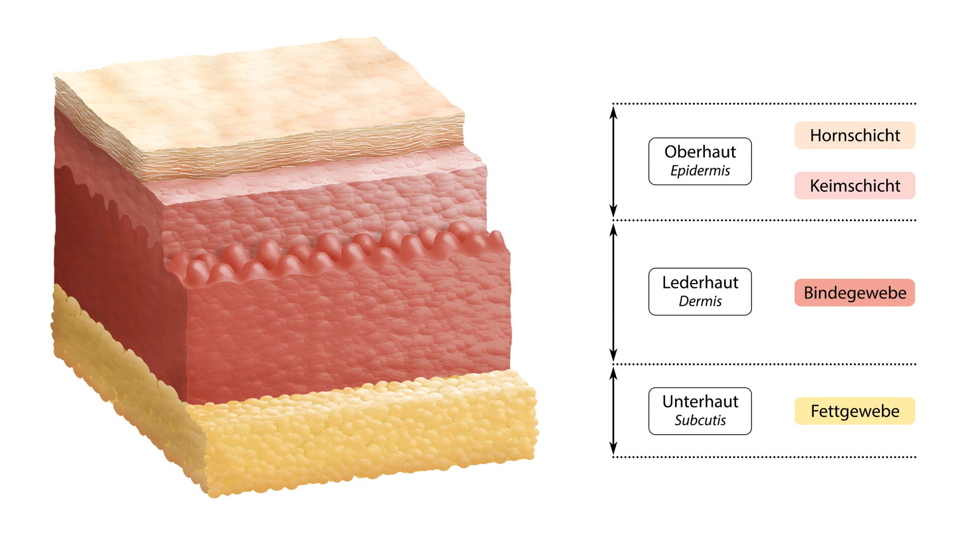 Schematische Darstellung des Aufbaus der Haut: unten das Fettgewebe (Unterhaut), danach Bindegewebe (Lederhaut), dann oben Keimschicht und Hornschicht (Oberhaut/Epidermis). 