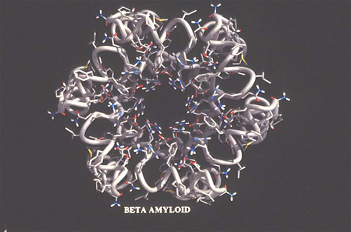 Amyloid-Beta-Peptid-Pore