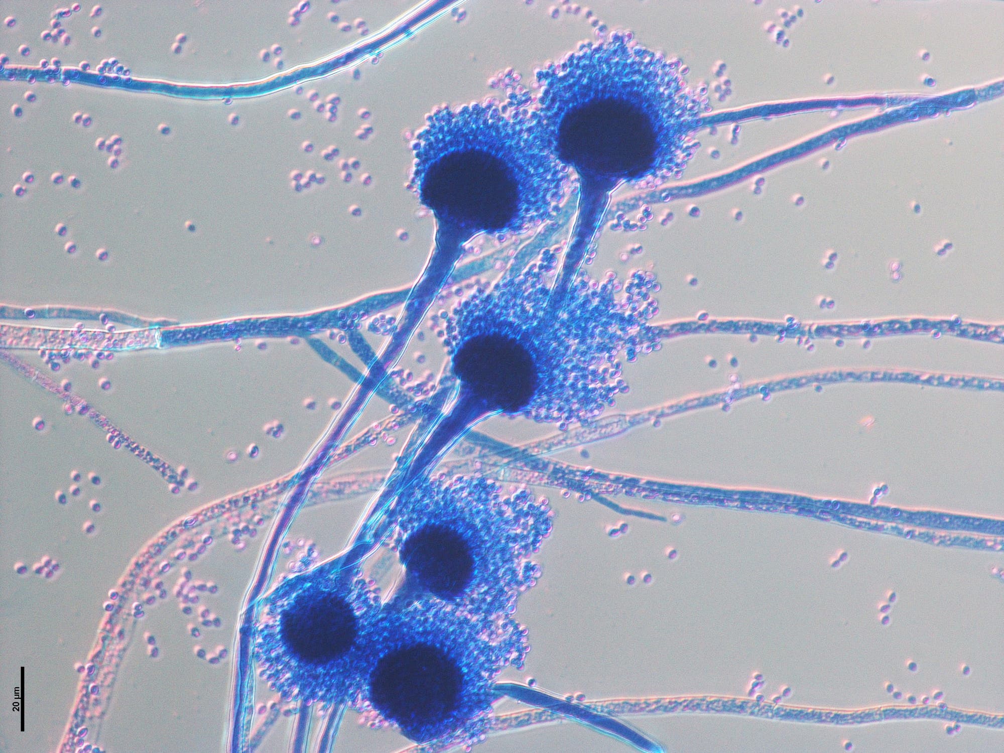 Mikroskopische Aufnahme des Pilzes Aspergillus fumigatus