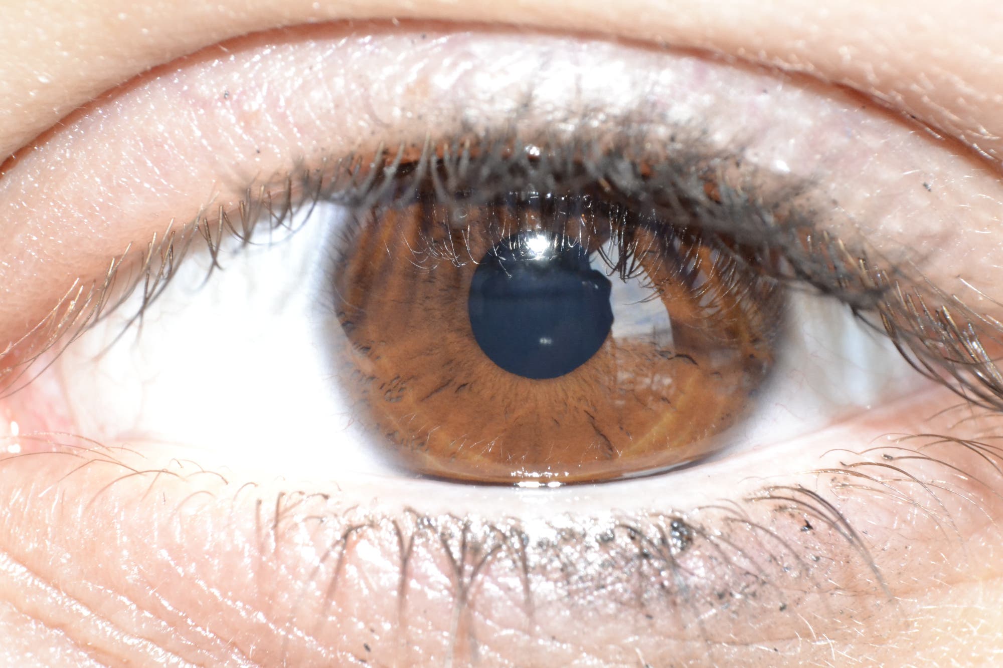 Auge mit brauner Iris