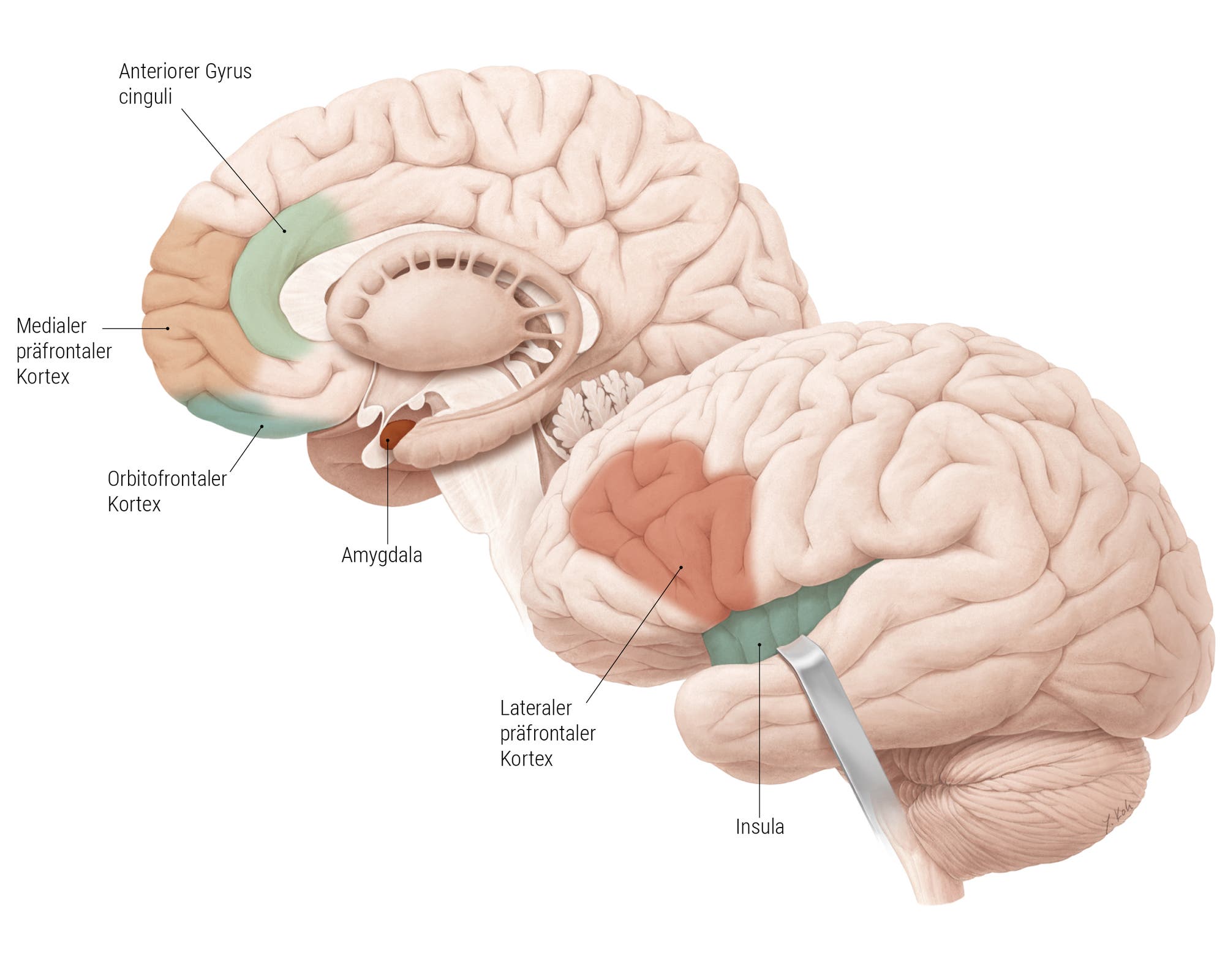 Seitliche Ansicht eines Gehirns, in dem folgende Areale farblich markiert sind: lateraler präfrontaler Kortex, Insula, orbitofrontaler Kortex, medialer präfrontaler Kortex, anteriorer Gyrus cinguli, Amygdala