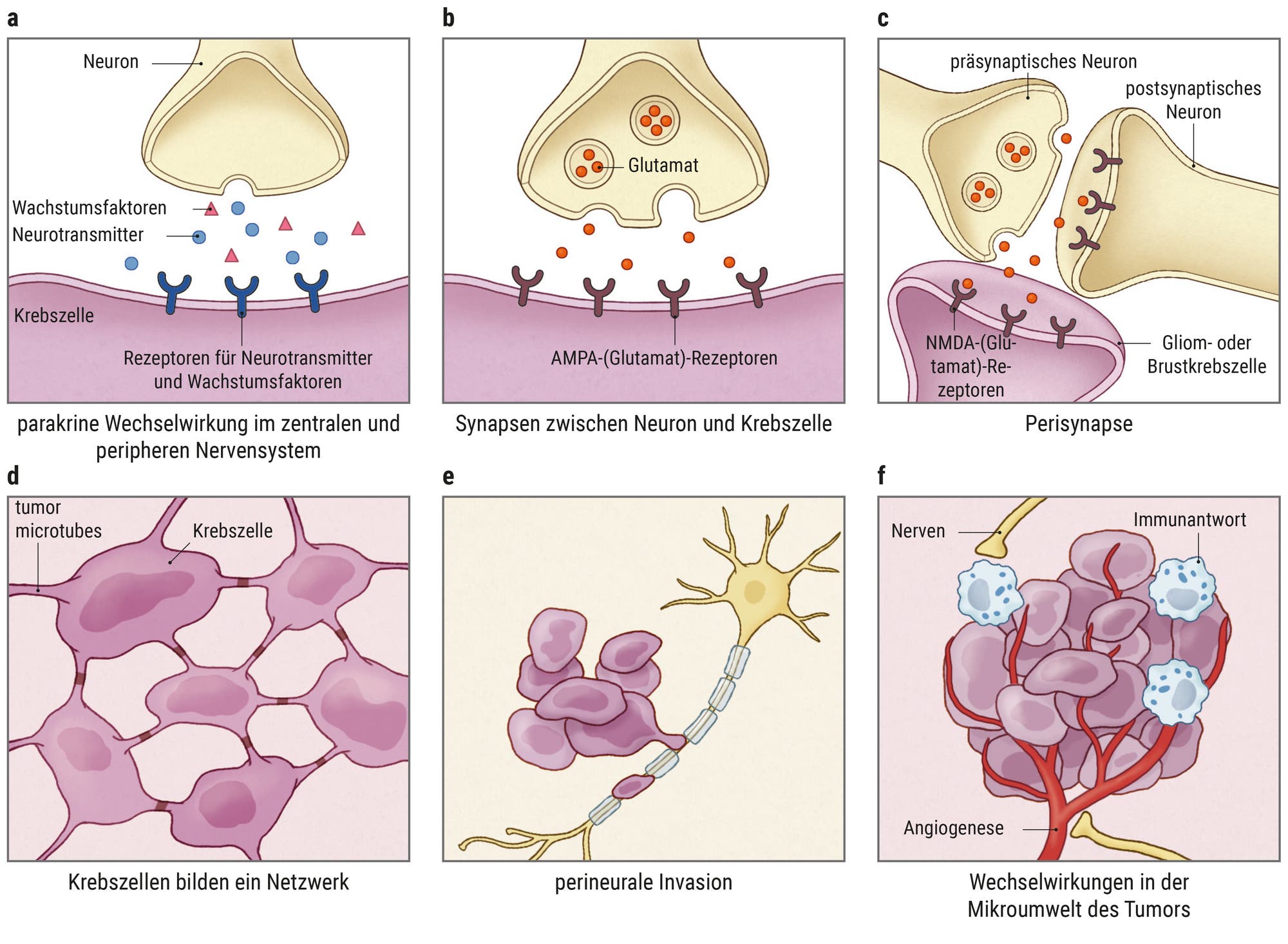 Infografik: die parakrine Wechselwirkung im zentralen und peripheren Nervensystem, die zur Entstehung eines Tumors führt.