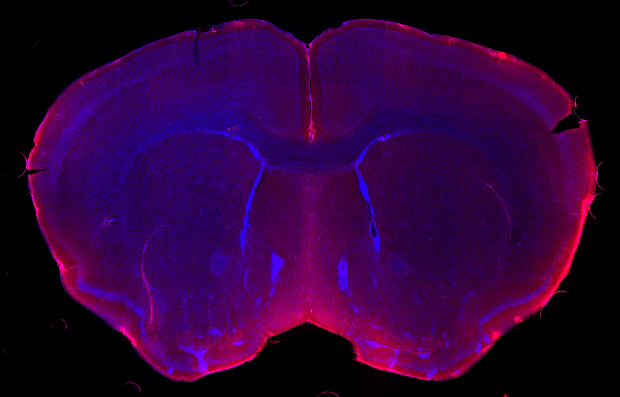 Cerebrospinale Flüssigkeit im Mäusehirn