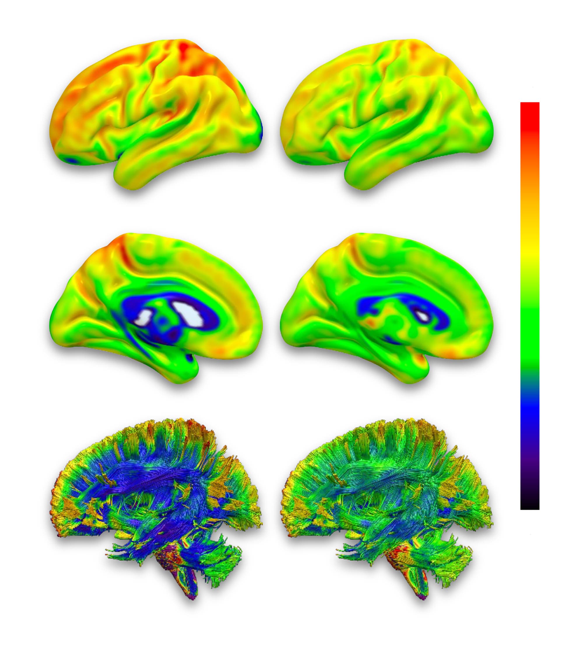 Darstellung von Gehirnscans in drei Reihen mit je zwei Bildern. Die obere Reihe zeigt seitliche Ansichten des Gehirns mit einer Farbskala von rot bis grün, die mittlere Reihe zeigt ähnliche Ansichten mit einer Farbskala von grün bis blau, und die untere Reihe zeigt detaillierte Strukturen in blau und grün. Rechts befindet sich eine Farbskala von 1.6 (rot) bis 0.4 (blau). Die Abbildung veranschaulicht unterschiedliche Datenverteilungen und Strukturen im Gehirn.