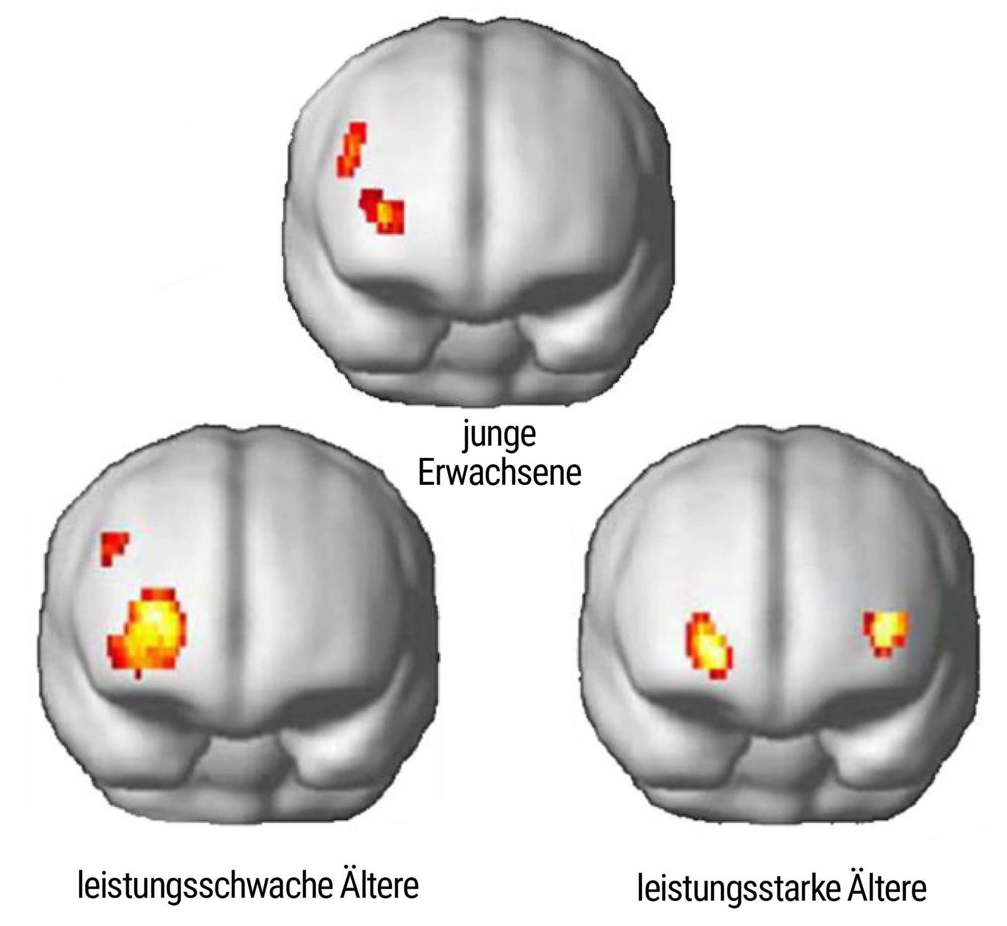 Drei Gehirnscans zeigen Aktivitätsmuster in verschiedenen Gruppen. Der obere Scan ist mit »YAs« (junge Erwachsene) beschriftet und zeigt moderate Aktivität im linken Bereich. Unten links zeigt der Scan »Low-Perf. OAs« (ältere Erwachsene mit niedriger Leistung) eine stärkere Aktivität im linken Bereich. Unten rechts zeigt der Scan »High-Perf. OAs« (ältere Erwachsene mit hoher Leistung) moderate Aktivität in beiden Bereichen. Die Aktivität ist durch rote und gelbe Markierungen hervorgehoben.
