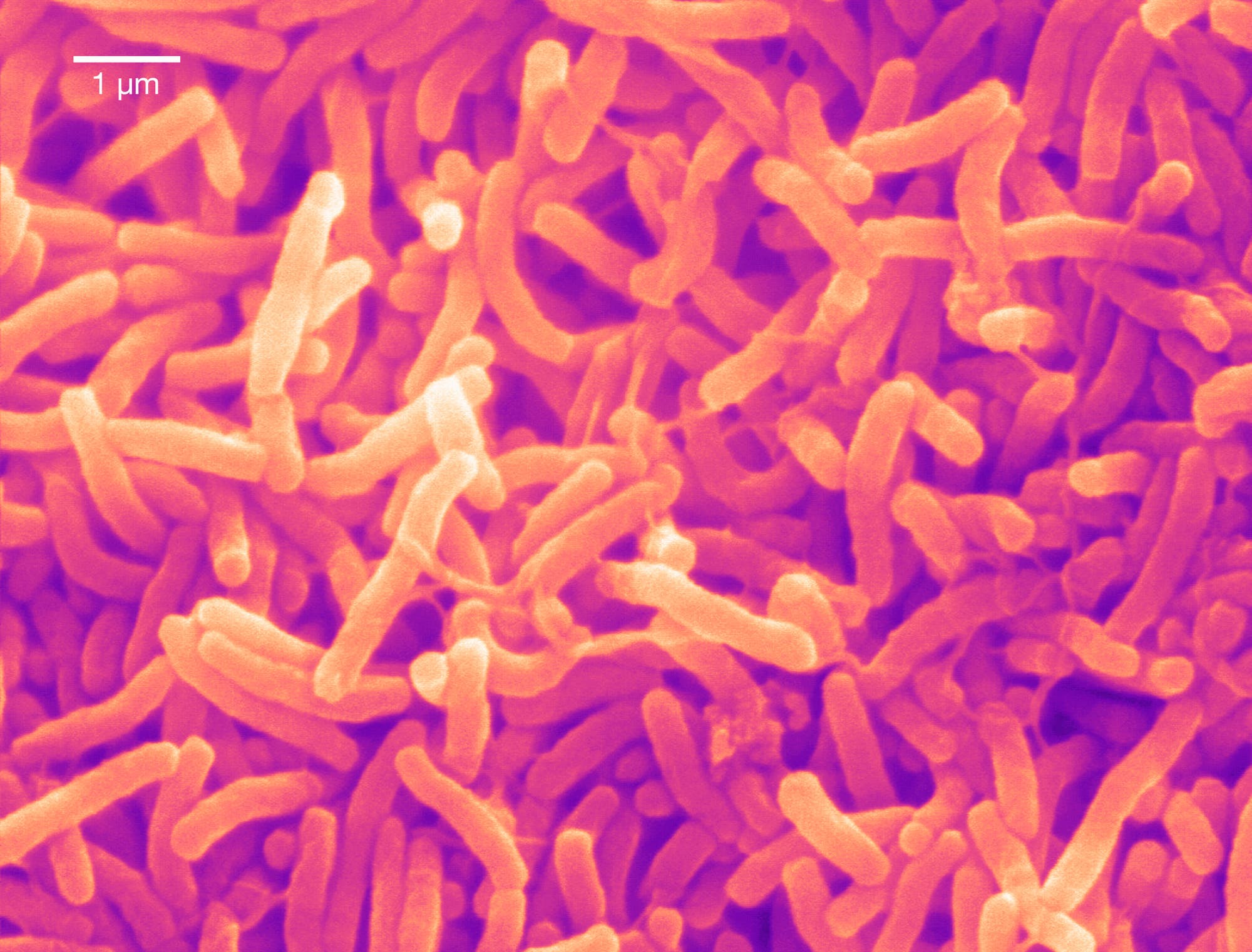 Cholerabakterien