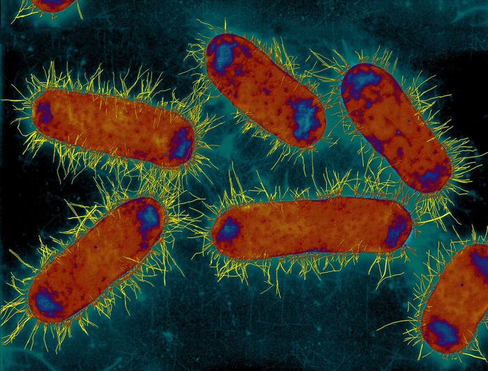Escherichia coli, 250 000-fach vergrößert