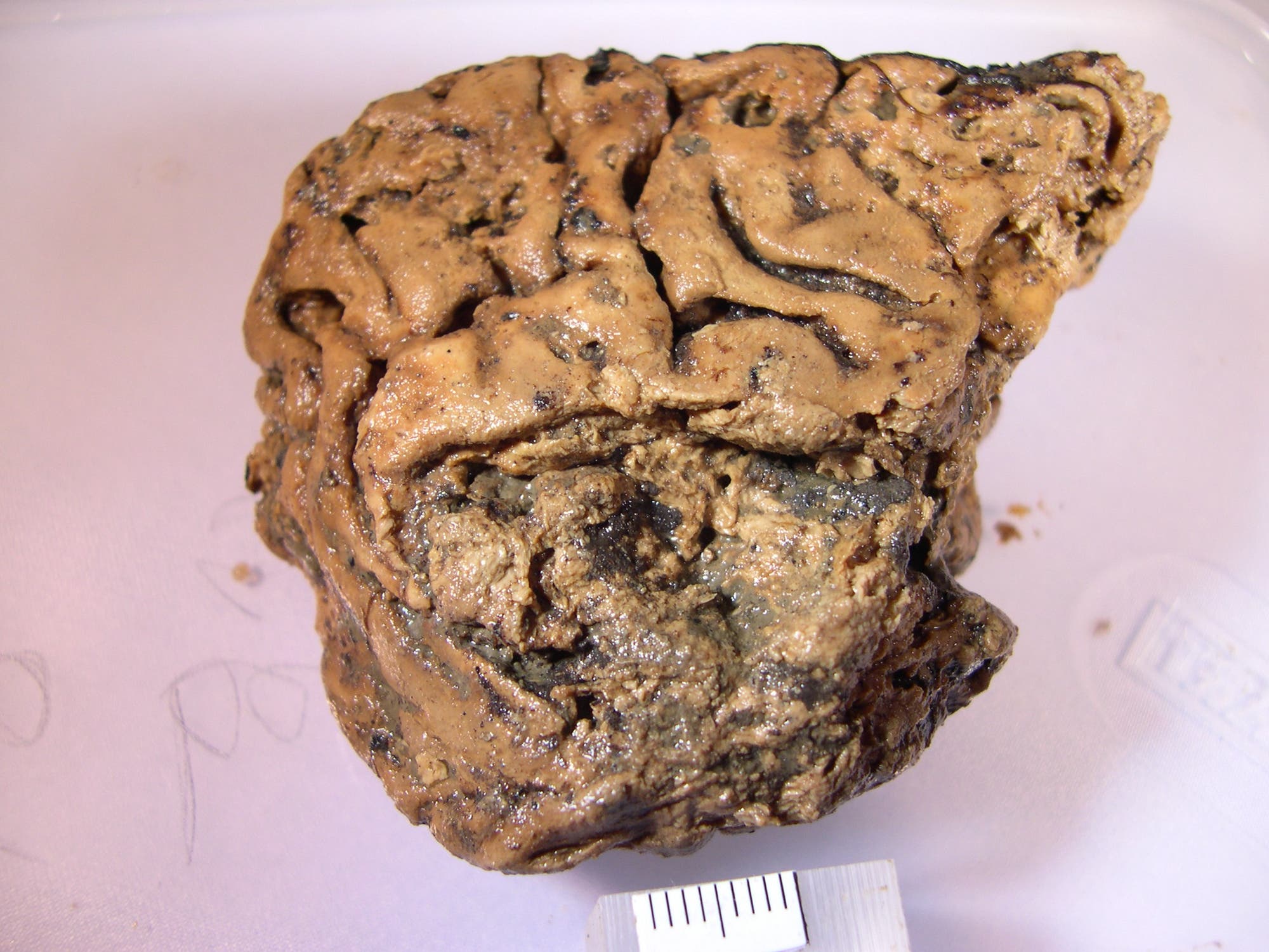 2600 Jahre altes Heslington-Gehirn