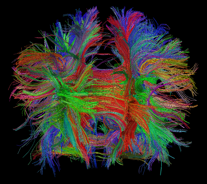 Farbenfrohes Gehirn