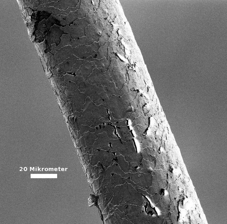 Haar im Elektronenmikroskop
