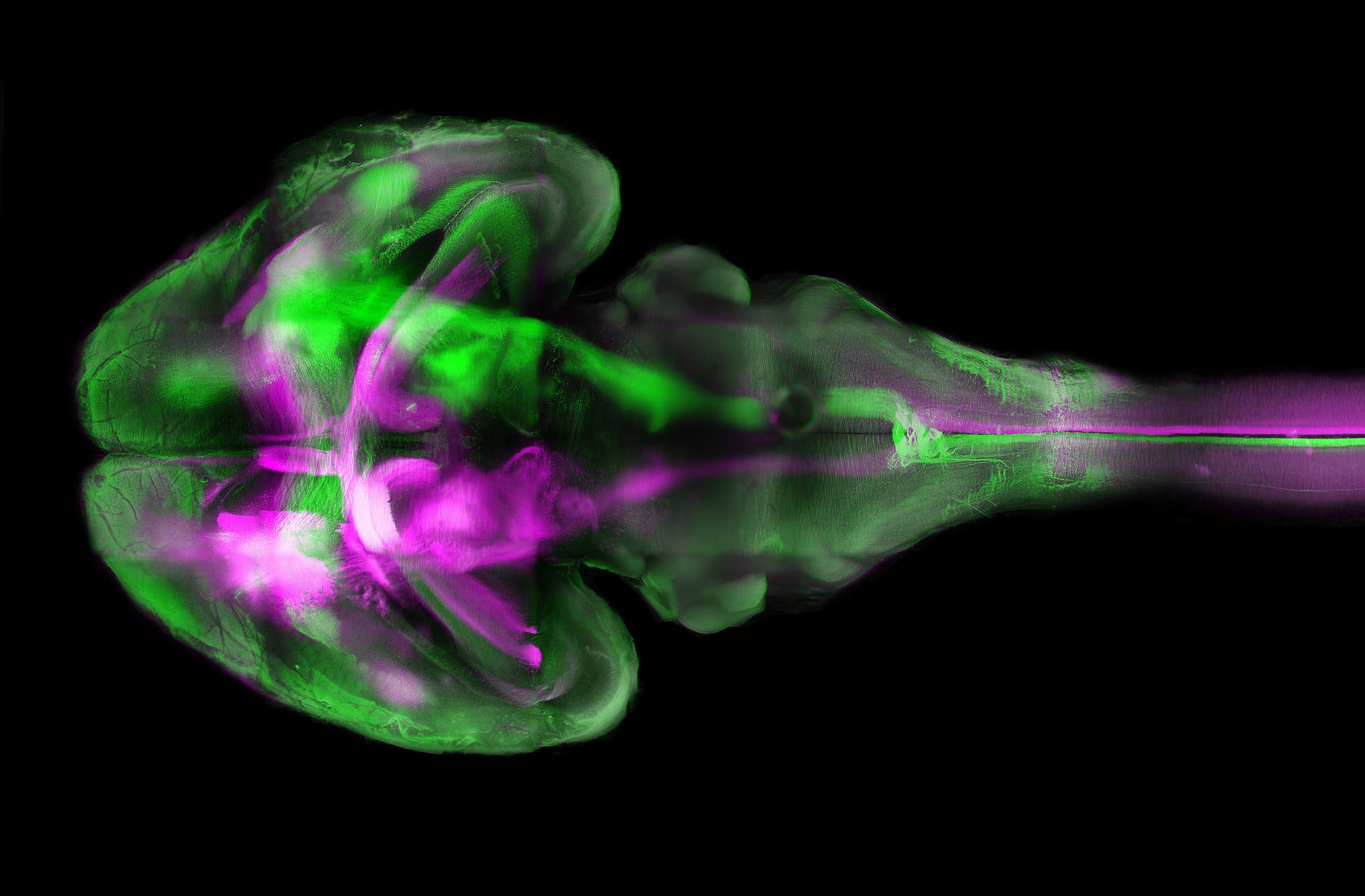 Gehirn mit rot und grün fluoreszierenden Motorcortices und Motorneuronen zum Rückenmark