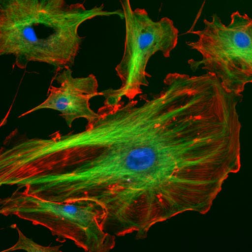 Endothelzelle mit Fluoreszenzmarkiertem Zellskelett