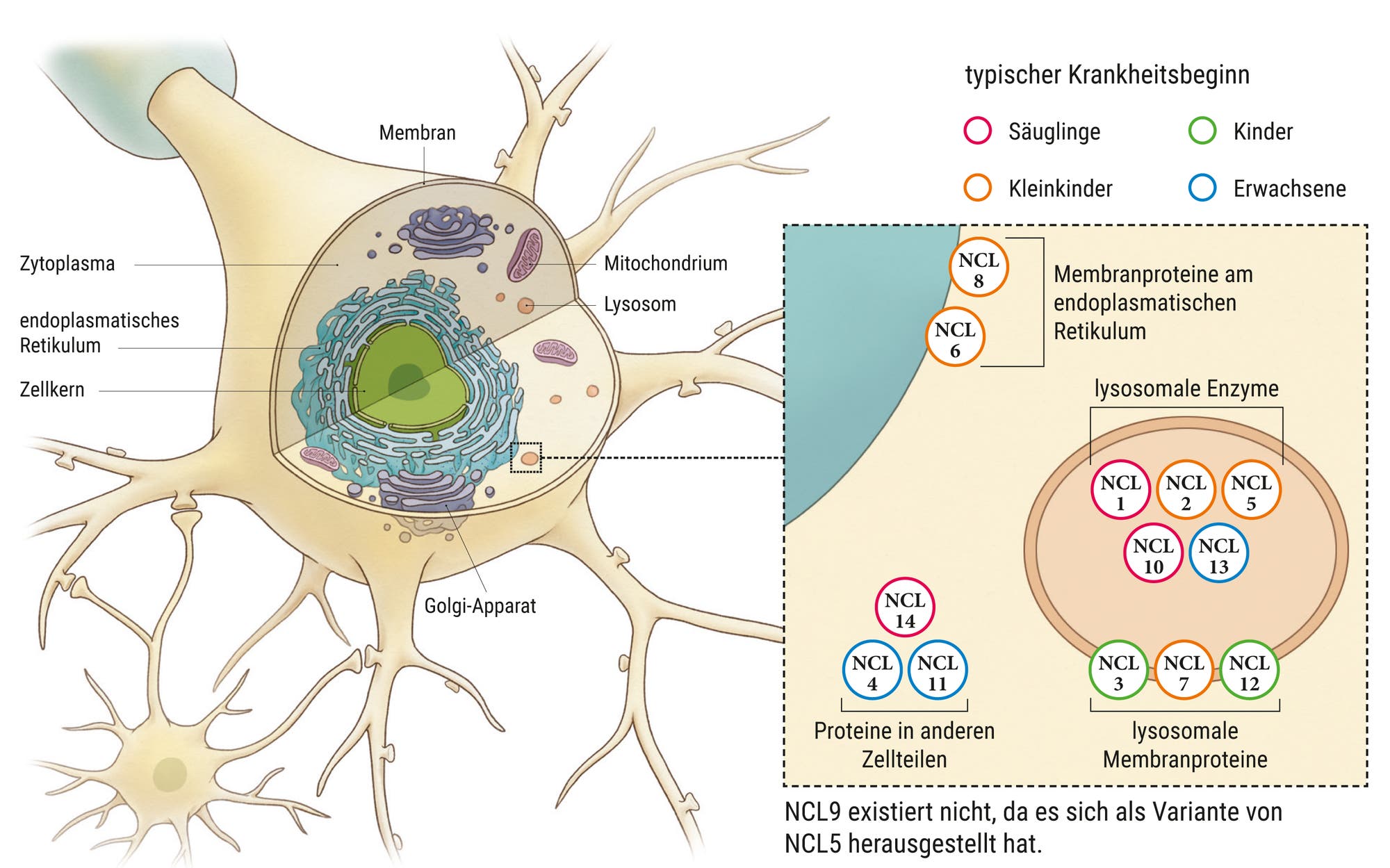 NCL-Neurone unter der Lupe
