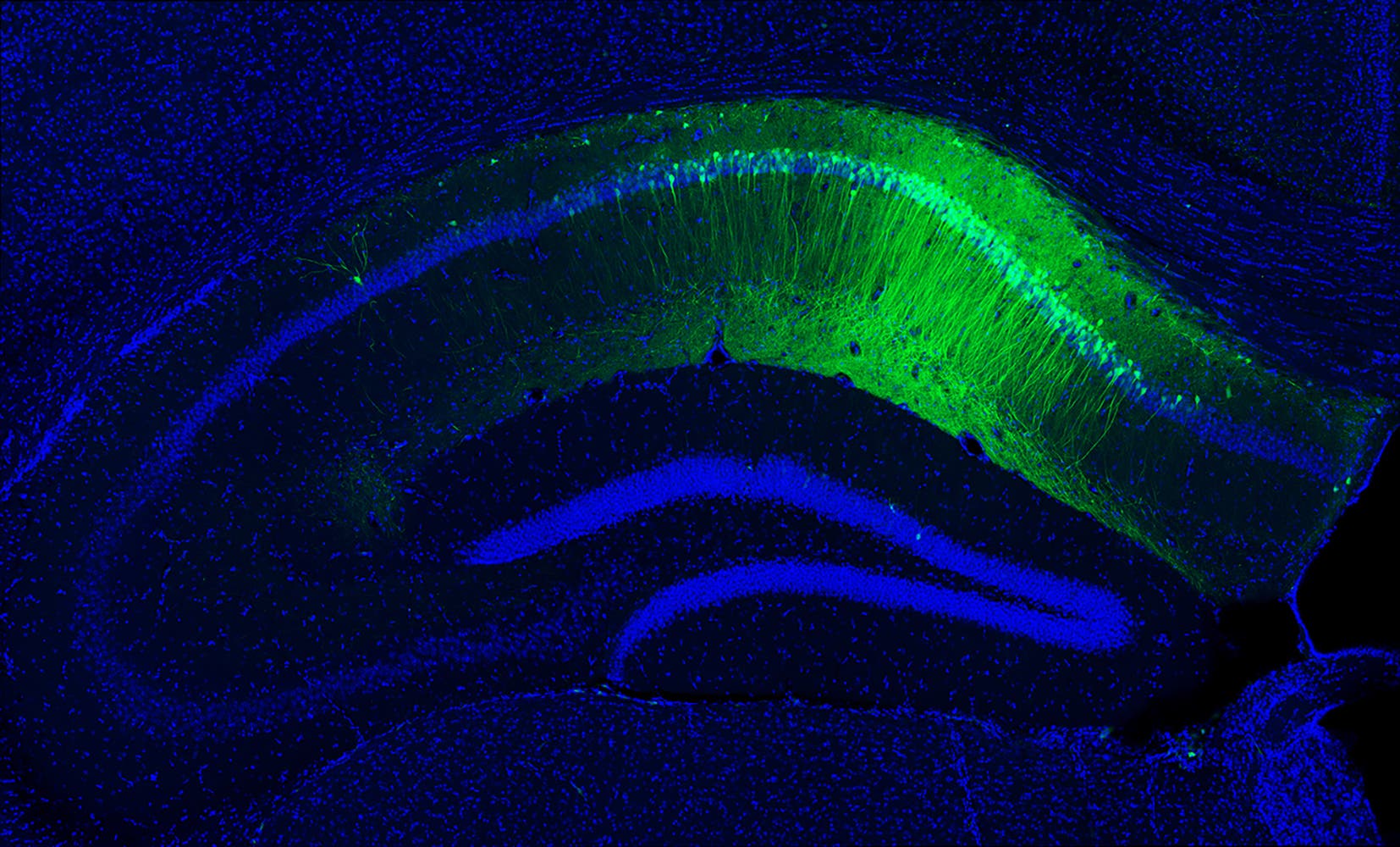 Leuchtende Gedächtnisspuren (Mikroskopaufnahme eines Mäuse-Hippocampus)