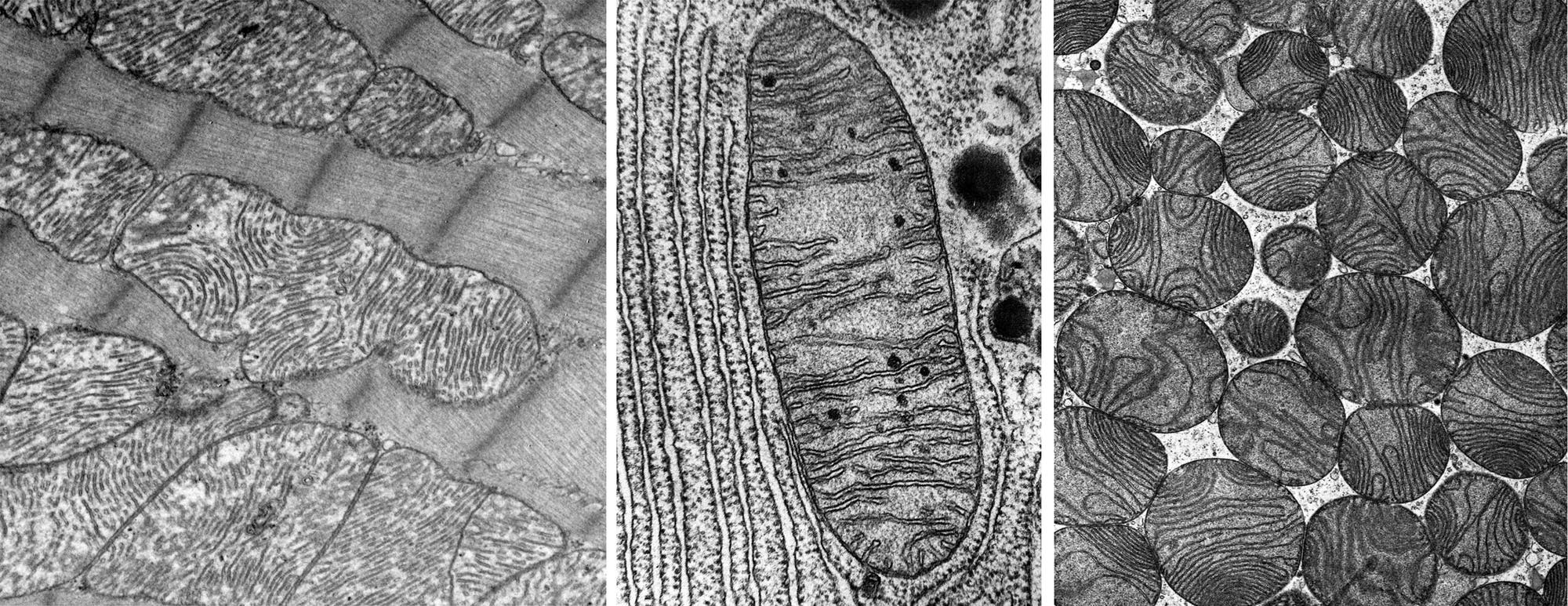 Elektronenmikroskopische Aufnahme, die drei verschiedene Zellstrukturen zeigt. Links sind längliche, gestreifte Strukturen zu sehen, die an Muskelgewebe erinnern. In der Mitte befindet sich eine ovale Struktur mit inneren Falten, die auf eine Mitochondrienstruktur hindeuten. Rechts sind runde, scheibenförmige Strukturen mit konzentrischen Mustern abgebildet, die möglicherweise Zellorganellen darstellen. Die Bilder zeigen feine Details der Zellarchitektur.