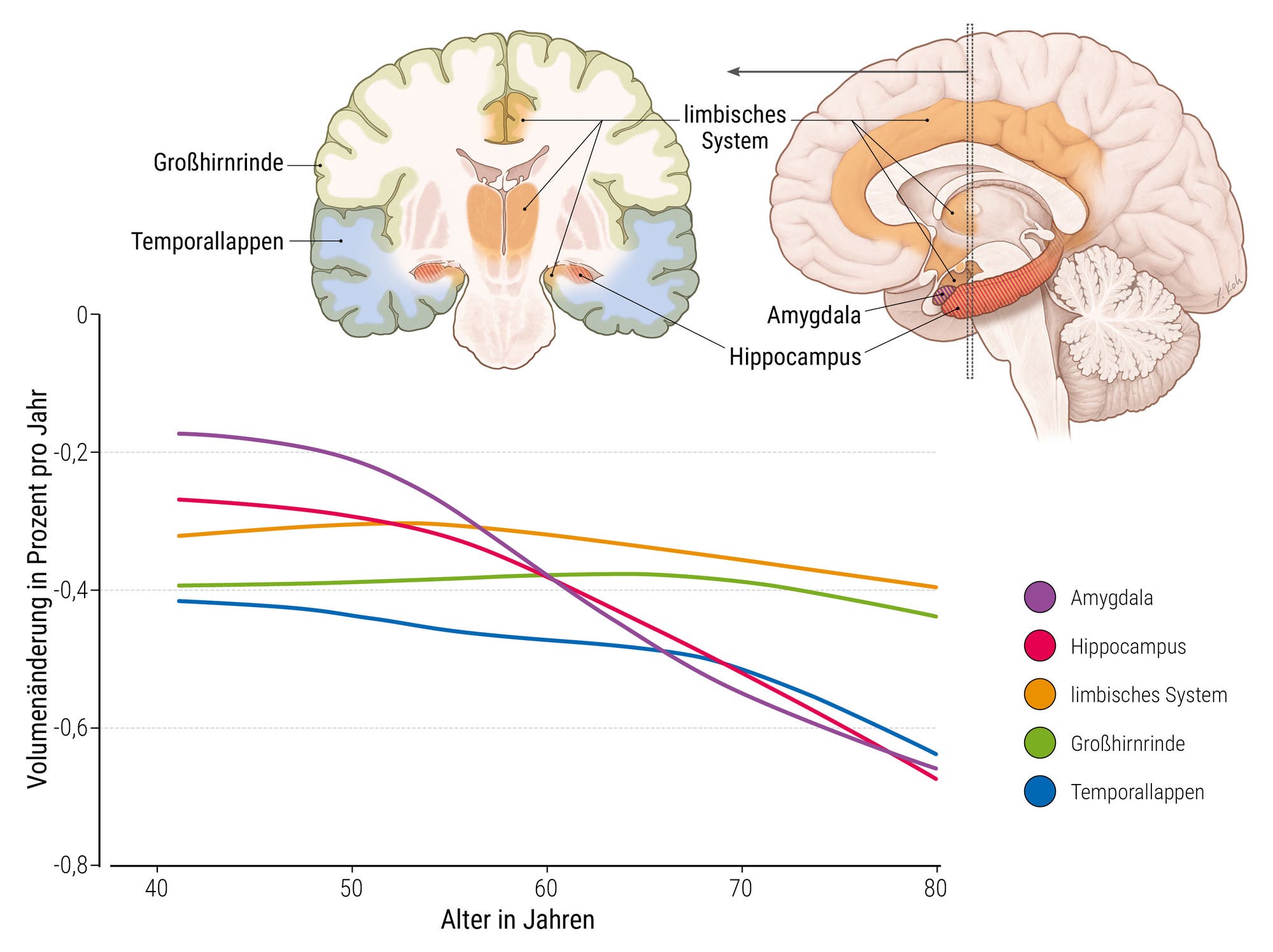 Ein anatomisches Diagramm zeigt eine seitliche Ansicht des menschlichen Gehirns mit hervorgehobener Amygdala und dem Parasympathikus/Vagusnerv. Rechts daneben befindet sich ein Liniendiagramm, das den Volumenänderungsgrad verschiedener Hirnstrukturen im Zusammenhang mit dem Alter und der Intensität neurodegenerativer Erkrankungen darstellt. Die Linien repräsentieren die Amygdala, den zerebralen Kortex, den Hippocampus, das limbische System und den Temporallappen. Die x-Achse zeigt das Alter in Jahren, die y-Achse die Volumenänderungsrate.