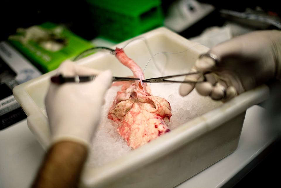 Transplantation von Schweineorganen