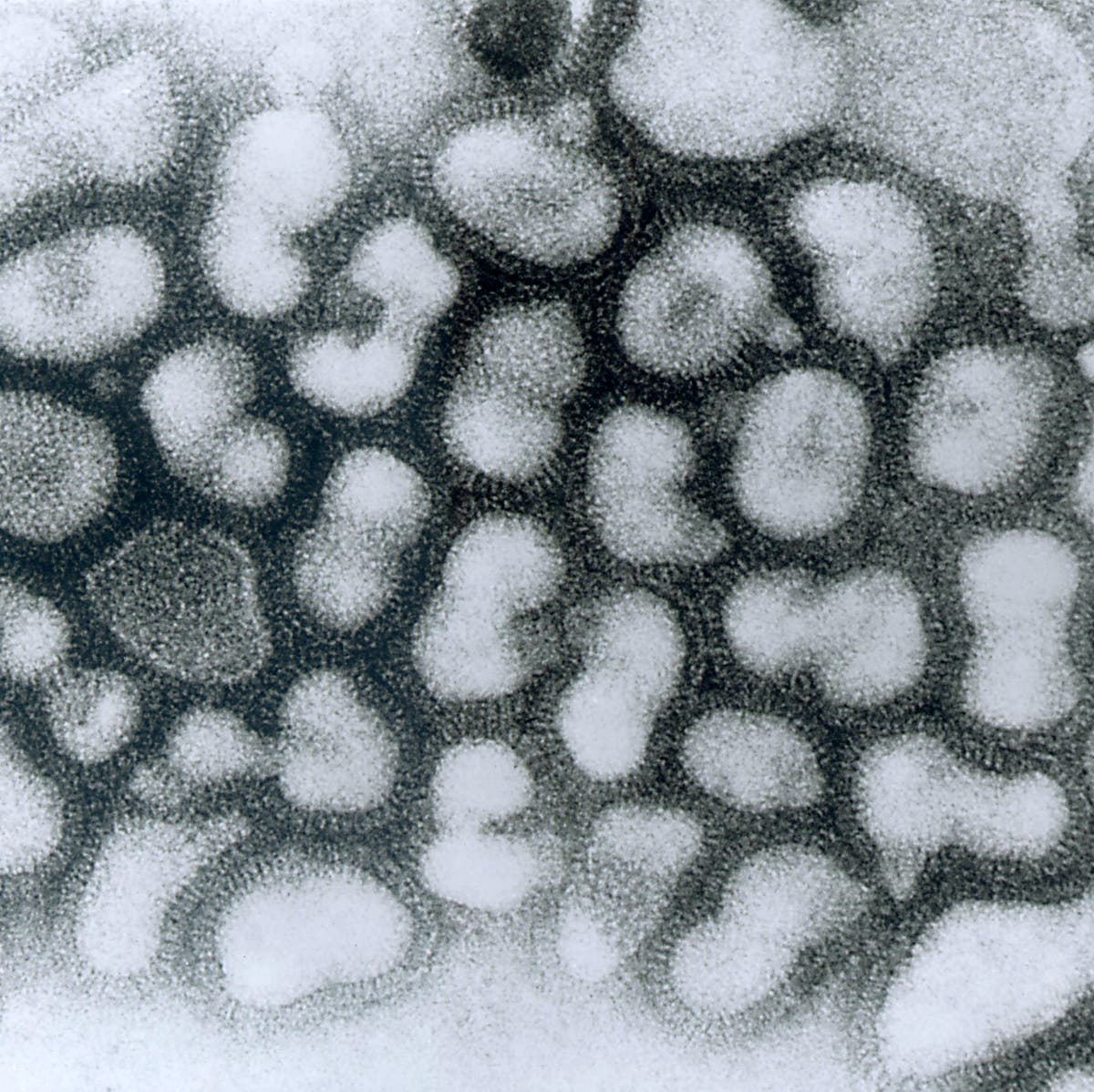 H5N1-Viren
