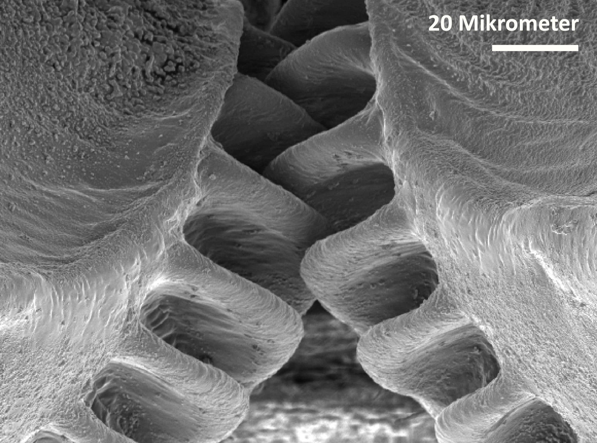 Schwarz-Weiß-Aufnahme aus einem Elektronenmikroskop: Oben rechts ist ein Maßstab von 20 Mikrometern eingeblendet. Das Bild zeigt Details der beiden zahnradförmigen Strukturen an den Hinterbeinen der Käferzikaden.