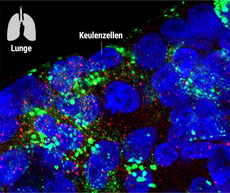 Lungenorganoid