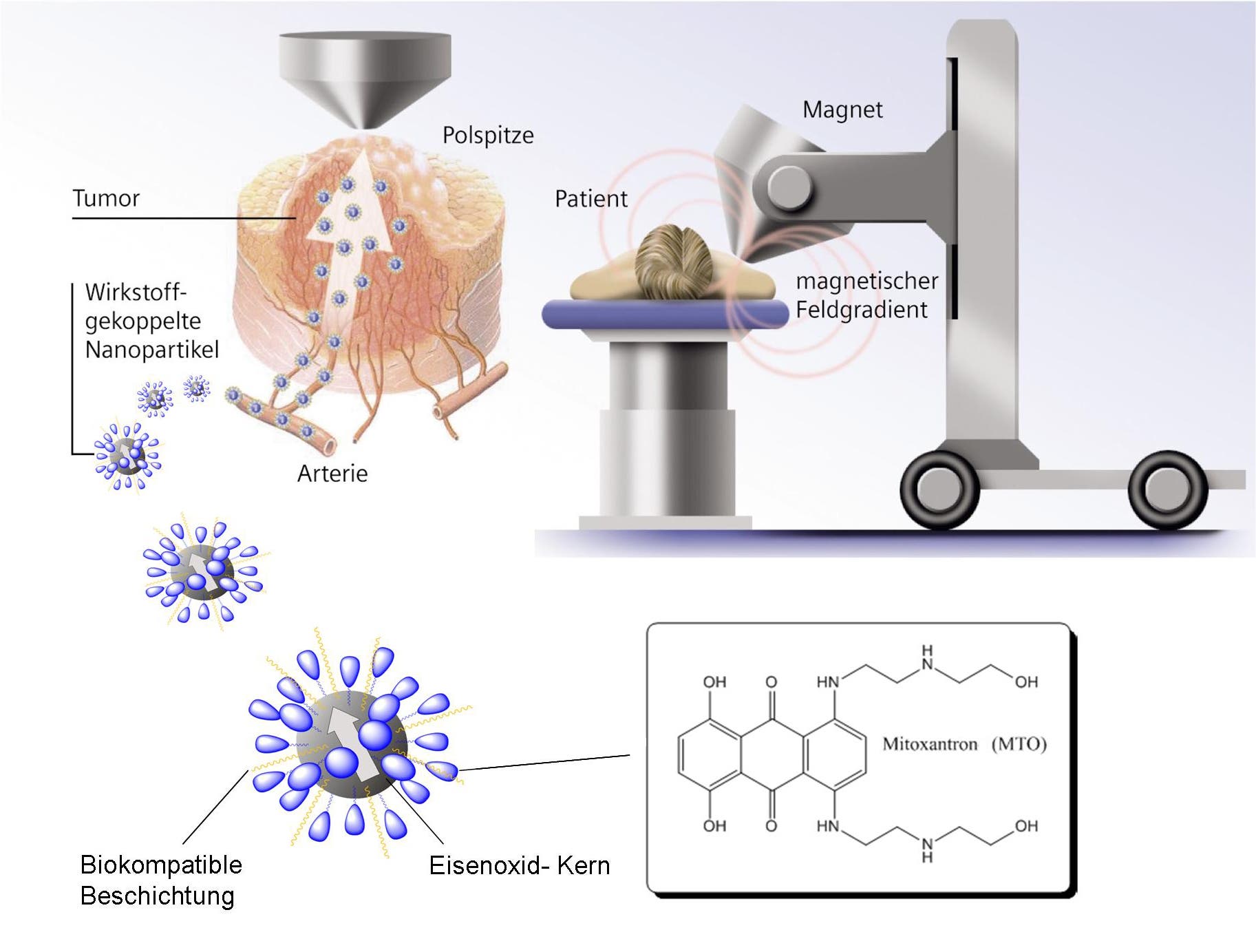 Mit Nanopartikeln zum Tumor 