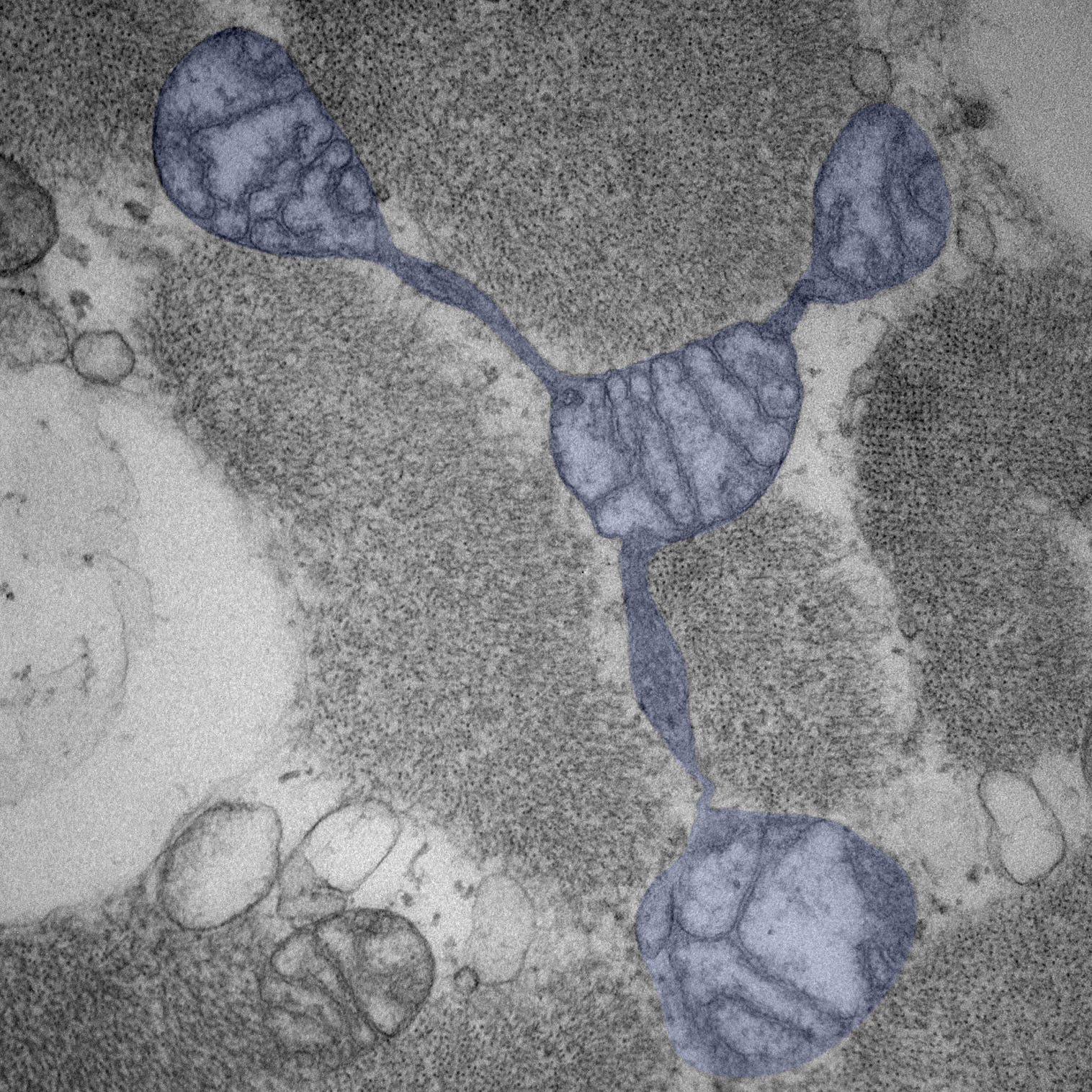Ein elektronenmikroskopisches Bild zeigt eine zelluläre Struktur mit mehreren blasenartigen Ausstülpungen, die durch schmale Verbindungen verbunden sind. Die Ausstülpungen sind blau hervorgehoben. Das Bild illustriert die feine Struktur und Verbindung innerhalb der Zelle.