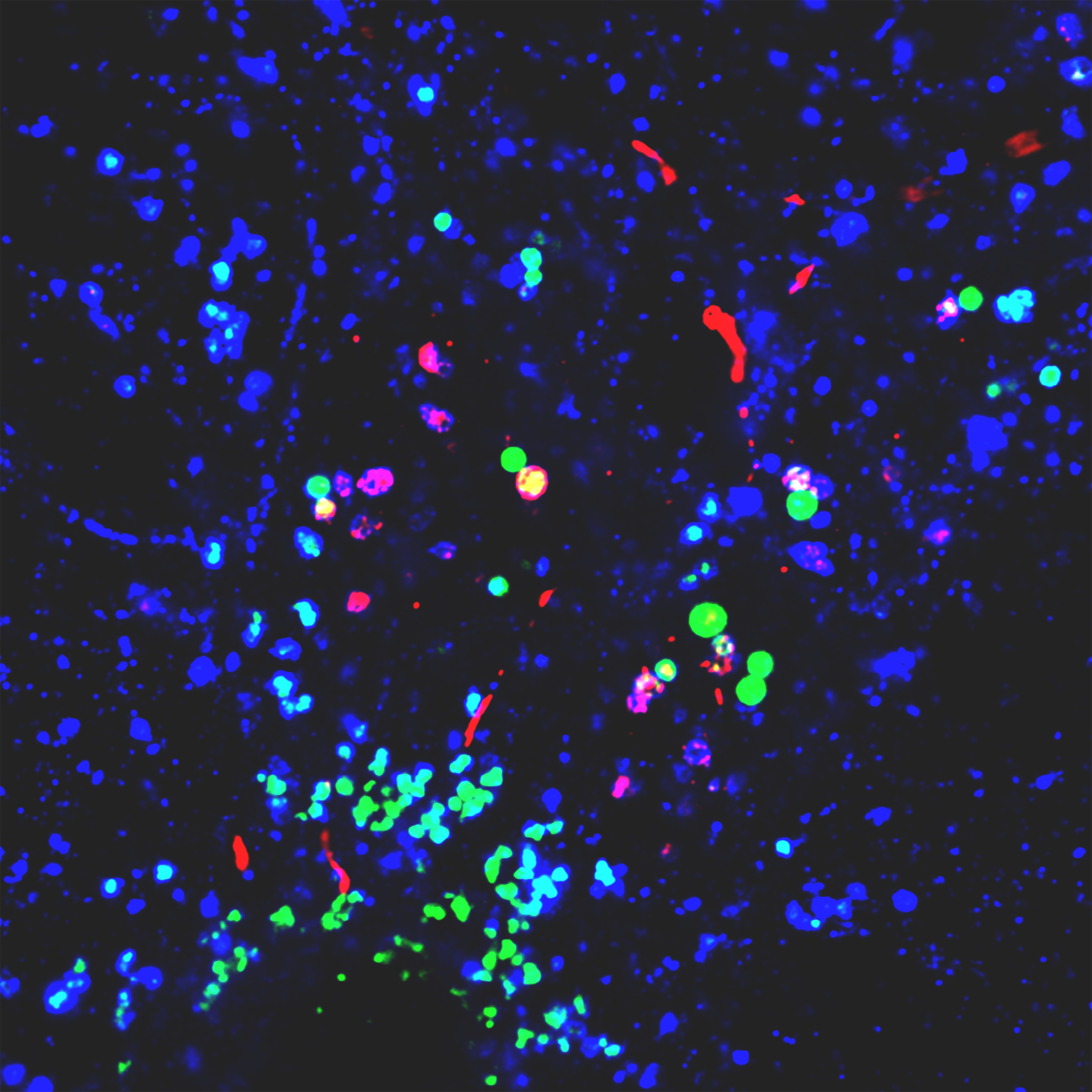 Unterm Mikroskop ist eine Mischung aus Nanoplastik, Lysosomen und Proteinen in verschiedenen Farben erkennbar