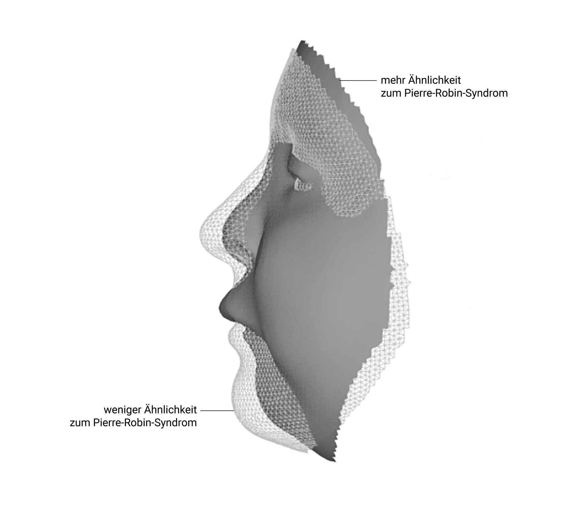 Graues Gesicht im Profil mit zwei unterschiedlichen Konturen: eines mit fliehendem Kinn, eines mit normal geformtem Kinn