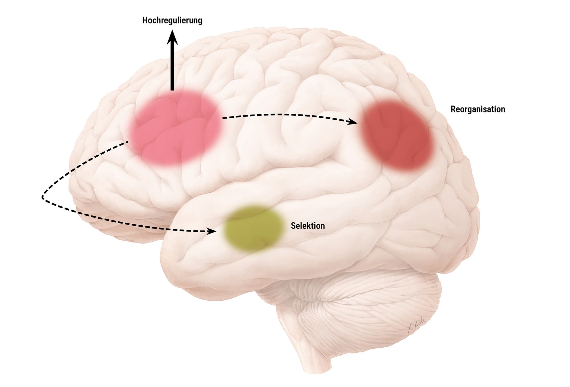 Diagramm eines Gehirns mit drei hervorgehobenen Bereichen, die durch rote Quadrate dargestellt sind. Pfeile zeigen Verbindungen zwischen diesen Bereichen. Der erste Bereich ist mit »Selection (qualitative change)« beschriftet und zeigt einen Pfeil zu einem zweiten Bereich, der mit »Upregulation (enhanced activity)« beschriftet ist. Ein weiterer Pfeil führt von diesem Bereich zu einem dritten Bereich, der als »Reorganization (alternative process)« gekennzeichnet ist. Das Diagramm veranschaulicht Prozesse der neuronalen Anpassung und Veränderung im Gehirn.