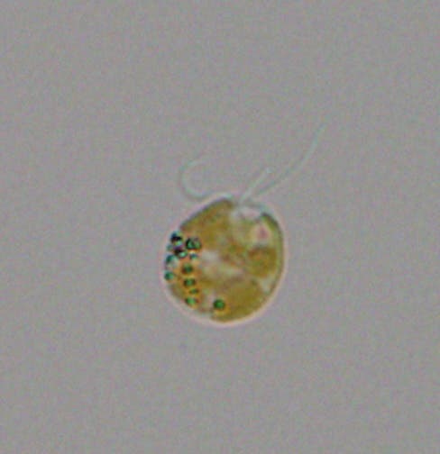 Micrografía del alga Prymnesium parvum