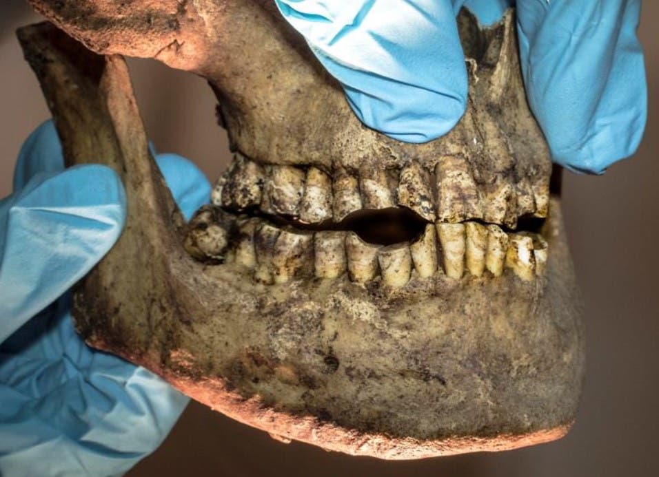 Eine Person mit blauen Handschuhen hält einen alten menschlichen Kieferknochen. Die Zähne sind sichtbar abgenutzt und verfärbt. Der Kieferknochen wird von beiden Seiten gehalten, um Details der Zahnstruktur zu zeigen.