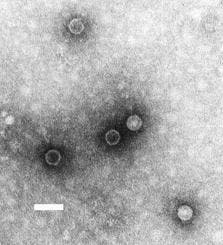 Poliomyelitis-Virus
