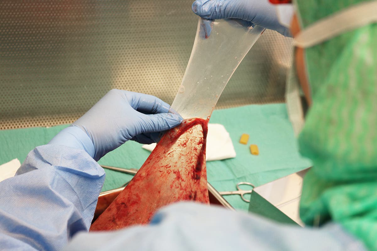 Eine Person in Schutzkleidung und blauen Handschuhen hält ein großes, blutiges Organ in einem Labor oder einer medizinischen Umgebung. Im Hintergrund sind sterile Instrumente und ein grünes Tuch zu sehen. Die Szene deutet auf einen medizinischen oder wissenschaftlichen Kontext hin.
