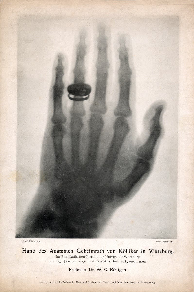 Röntgenbild der Hand des Anatomen Geheimrath von Kölliker vom 23. Januar 1896