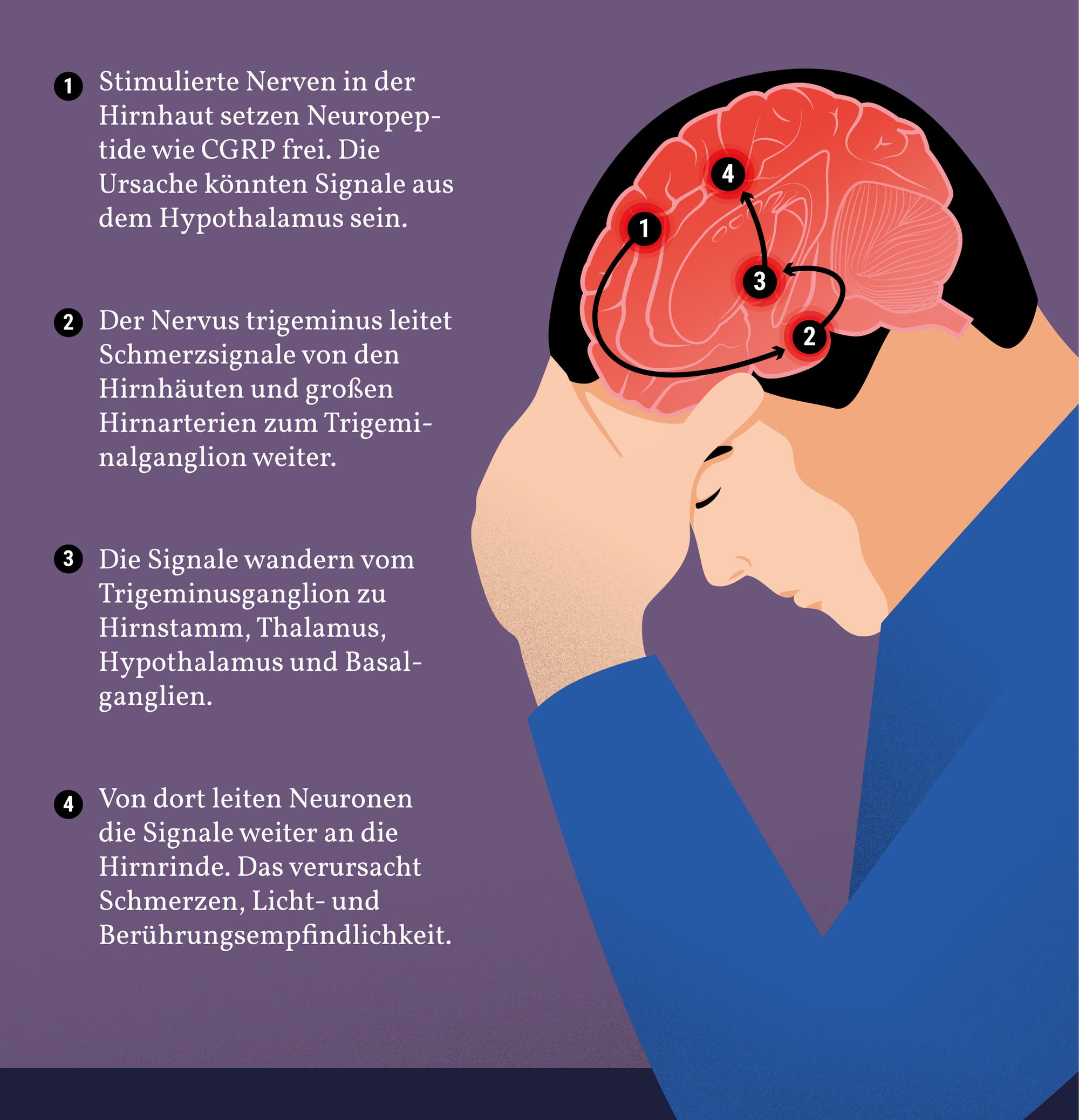 Die führende Theorie zu Migränekopfschmerzen: Der Hypothalamus stimuliert die Nerven, die mit den Blutgefäßen im Kopf verbunden sind, wie die Grafik zeigt.
