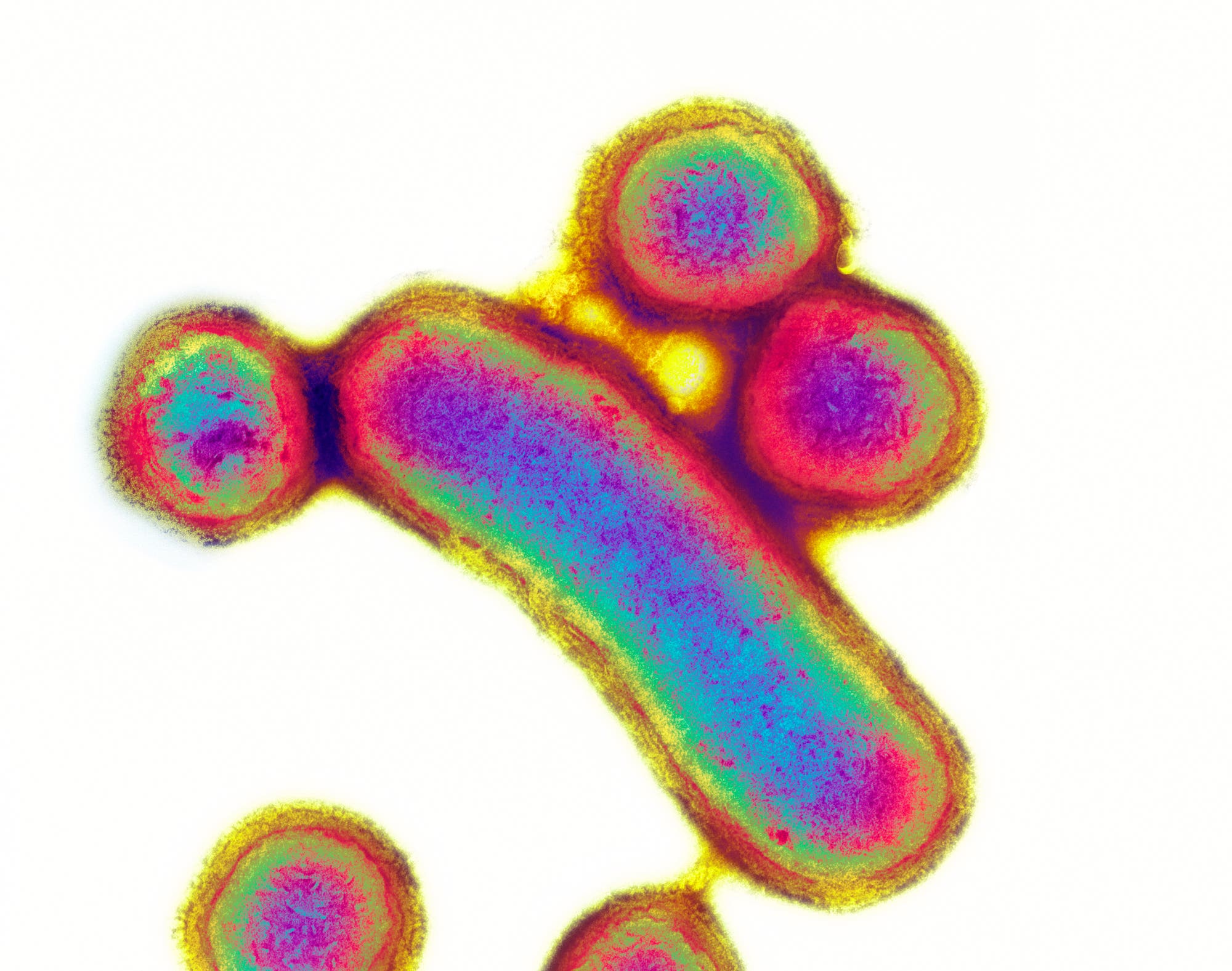 Transmissionselektronenmikroskopische Aufnahme von P. gingivalis