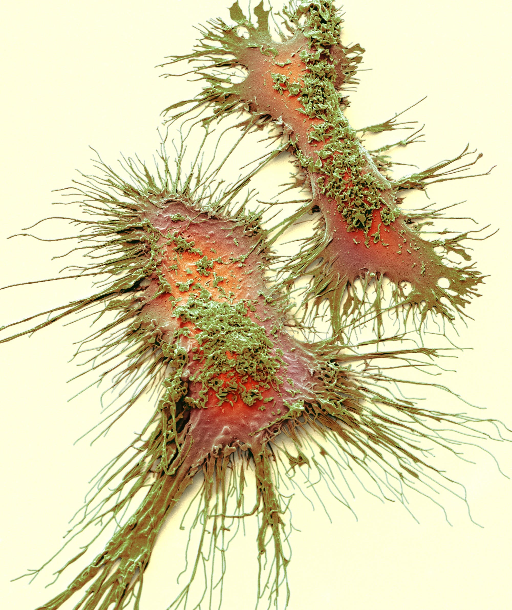 Eingefärbte rasterelektronenmikroskopische Aufnahme (SEM) von Mikrogliazellen. Die langen Fortsätze auf der Zelloberfläche dienen dazu, die Umgebung abzutasten und sich fortzubewegen. (1300-fache Vergrößerung bei einer Bildhöhe von 10 cm.)