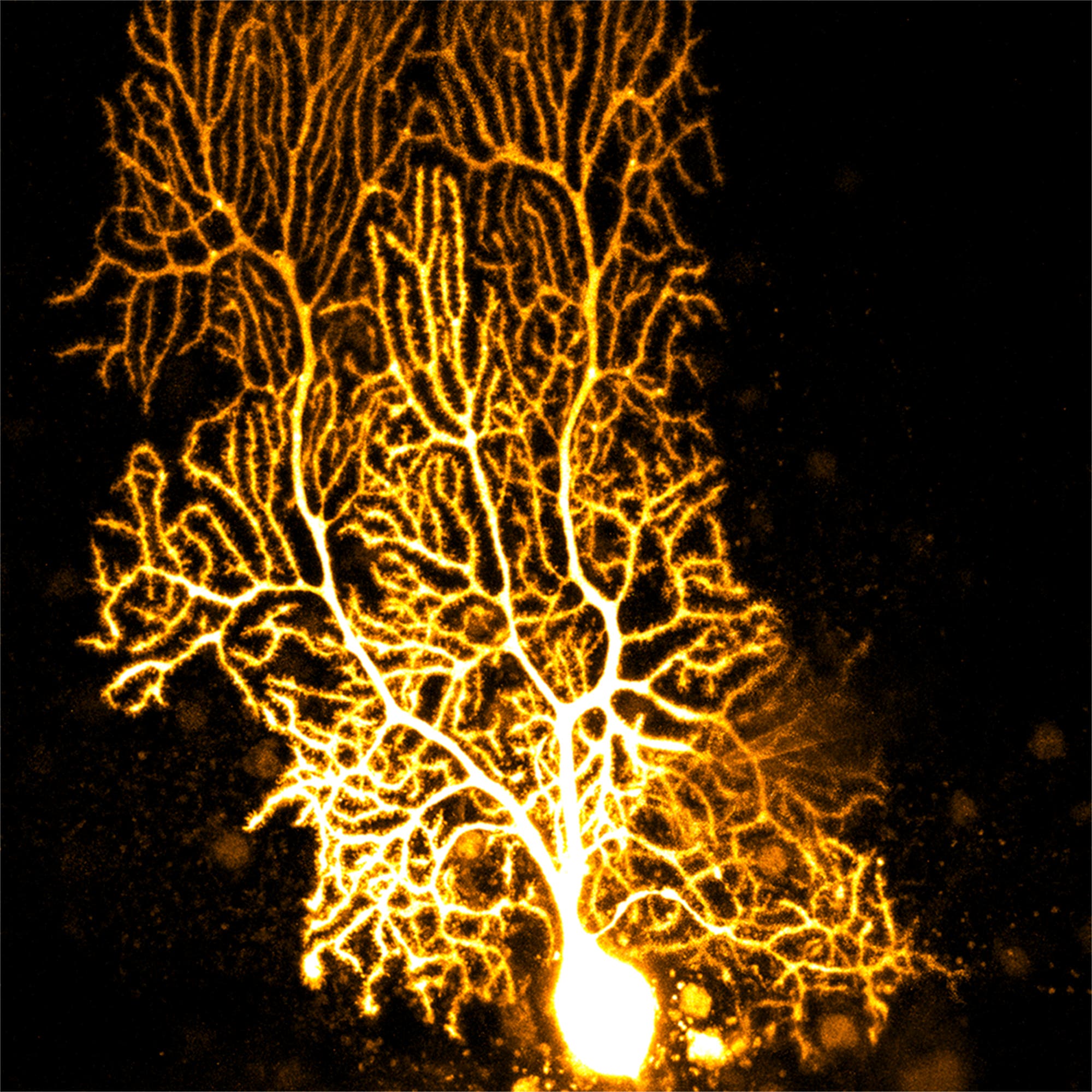 Lichtmikroskopische Aufnahme einer Purkinjezelle (einer weit verzweigten Nervenzelle), die nachträglich gelb eingefärbt wurde