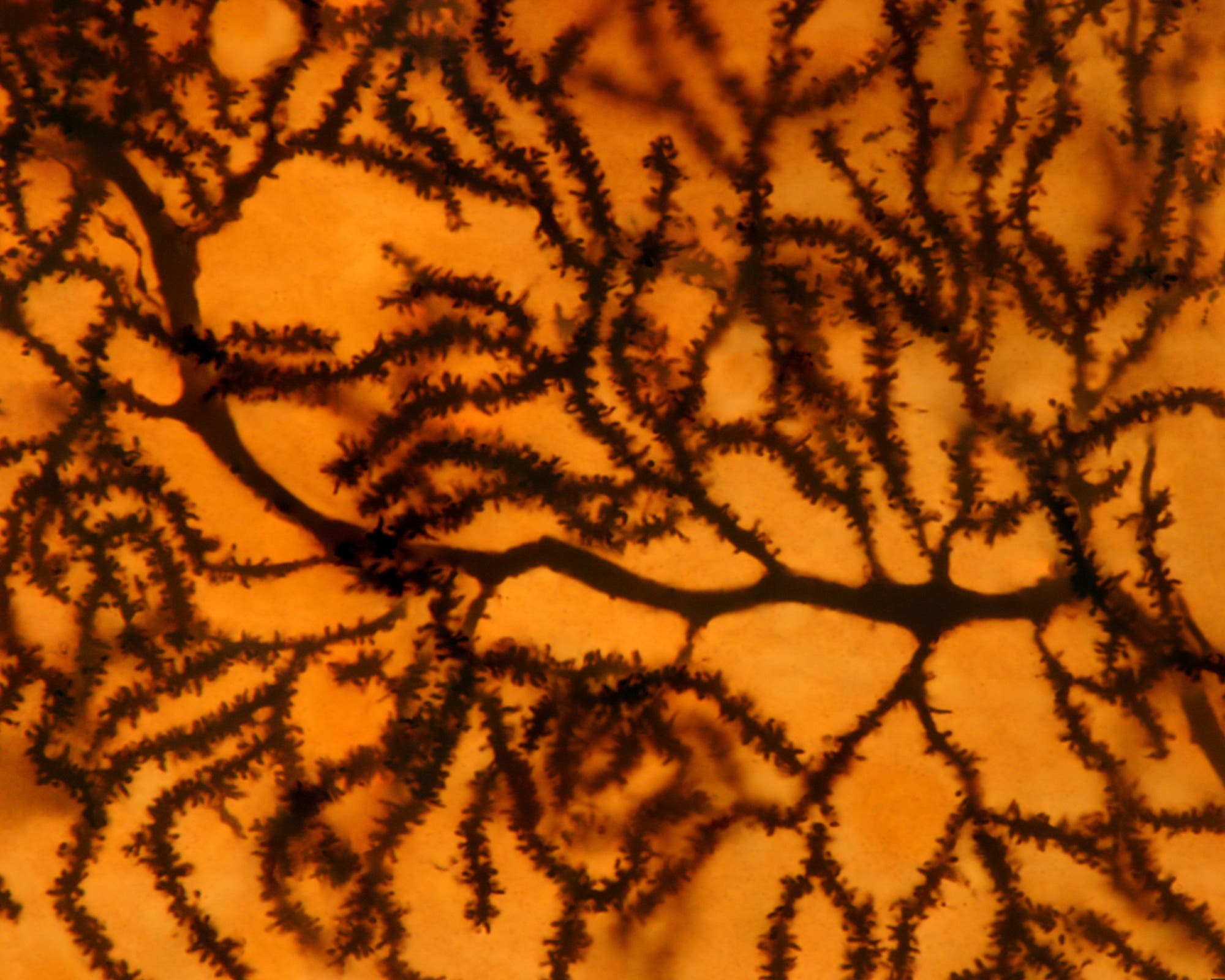 Die Dornenfortsätze auf den Dendriten einer Purkinjezelle in Großaufnahme unter dem Lichtmikroskop.