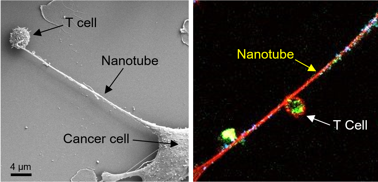 Elektronen- (links) und lichtmikroskopische (rechts) Aufnahme eines Krebszelltentakels