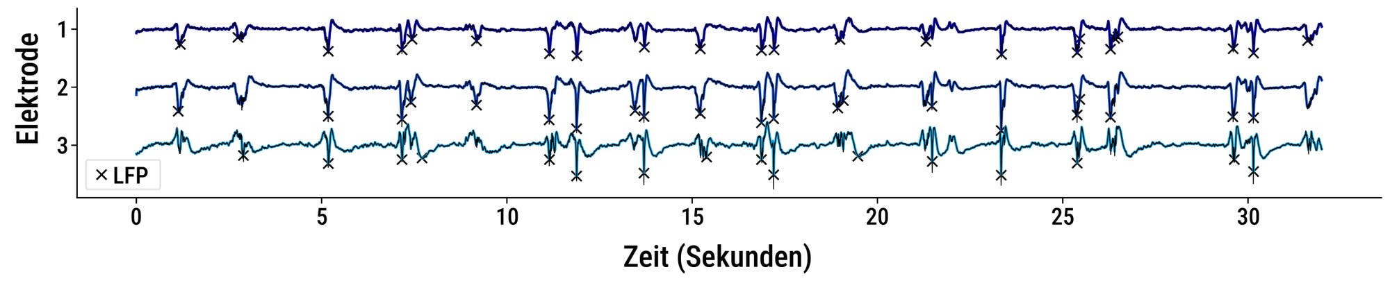 Ein Diagramm zeigt die elektrische Aktivität von drei Elektroden über 30 Sekunden. Die vertikale Achse ist mit "Elektrode" beschriftet und die horizontale Achse mit "Zeit (Sekunden)". Jede Elektrode zeigt eine unterschiedliche Wellenform, die Spitzen und Täler aufweist. Markierungen mit "X" kennzeichnen bestimmte Ereignisse entlang der Wellenformen. Die Farben der Linien variieren, um die Elektroden zu unterscheiden. Ein kleines Fenster links zeigt den Text "events".