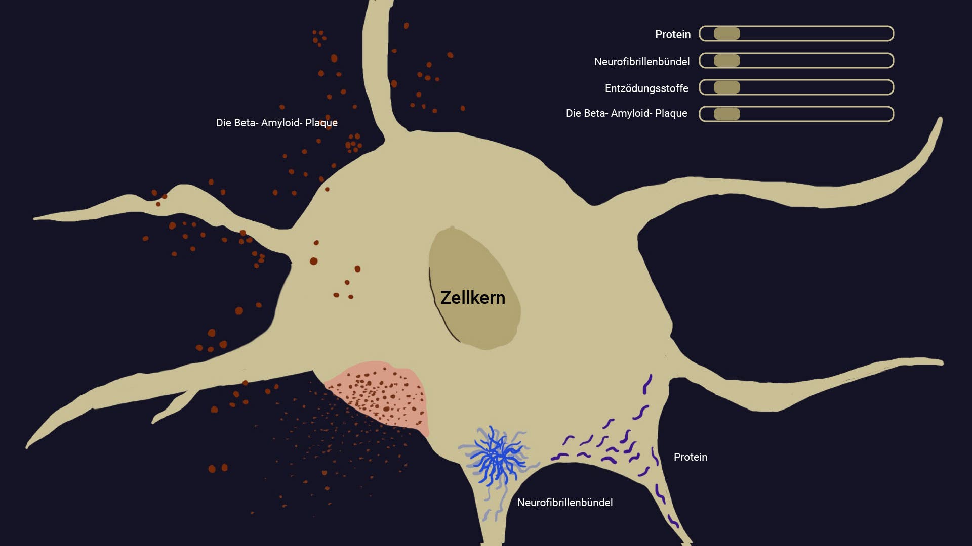 Zeichnung Neuron Alzheimer